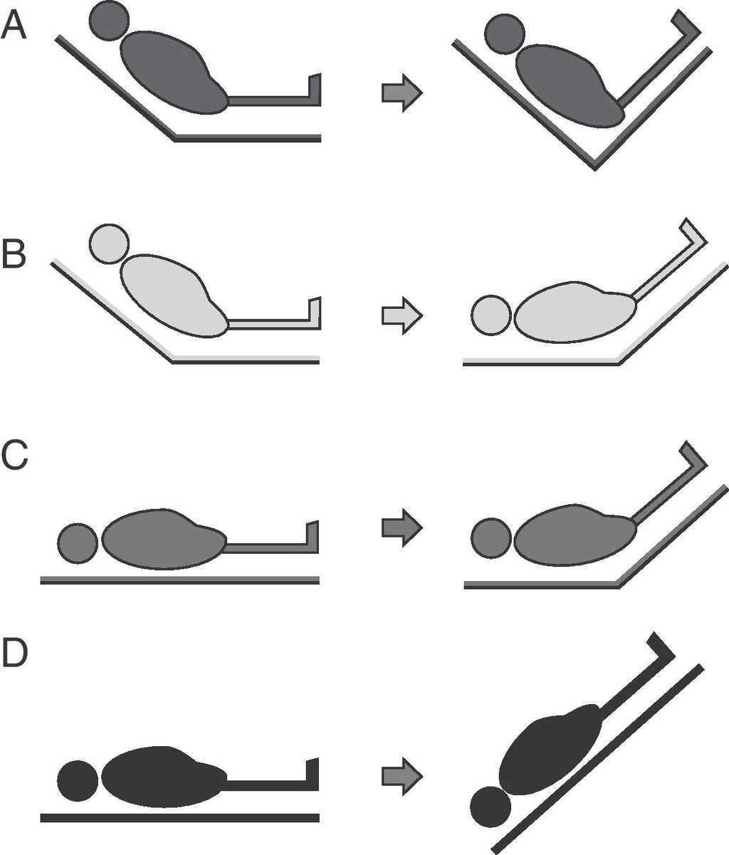 d. this modality is equivalent to applying the trendelenburg