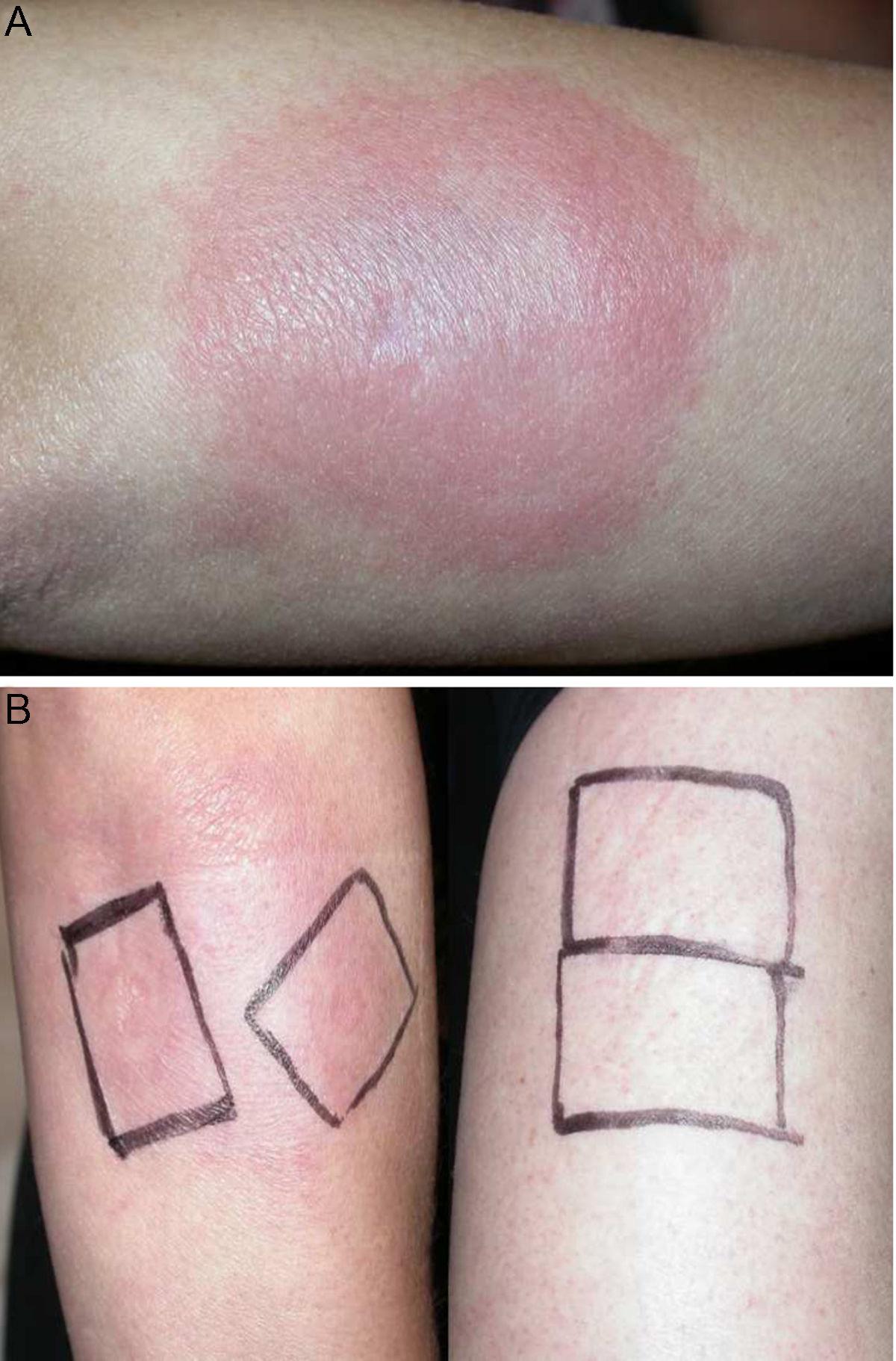 Estrógenos conjugados españa