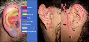 Esquema de la anatomía de la oreja y sus principales zonas anatómicas. Vascularización arterial del pabellón auricular: arteria auricular posterior (AAP) y sus ramos perforantes (AP). Carótida externa (CE), arteria maxilar (AM), arterias auriculares anteriores (AA), arteria temporal superficial (ATS).