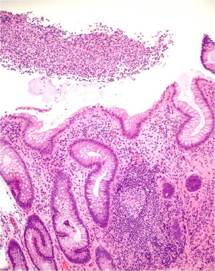 doxycycline online south africa