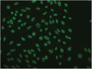Inmunofluorescencia indirecta anti-NuMA 1: tinción granular nuclear con tinción de fibras del huso mitótico. Imagen cortesía del Dr. Eiras (Departamento de Inmunología del Complejo Hospitalario Universitario de Santiago de Compostela).