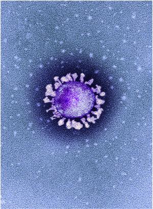 Colored transmission electron micrograph showing a SARS-CoV-2 particle isolated from a patient with COVID-19 in the United Kingdom. ©National Infection Service, United Kingdom/Science Photo Library/agefotostock. Note the characteristic outward projecting spikes or protuberances on the surface and the markedly irregular rim and somewhat heterogeneous morphology.