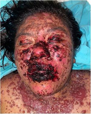 Case 3: Condition after 96h.