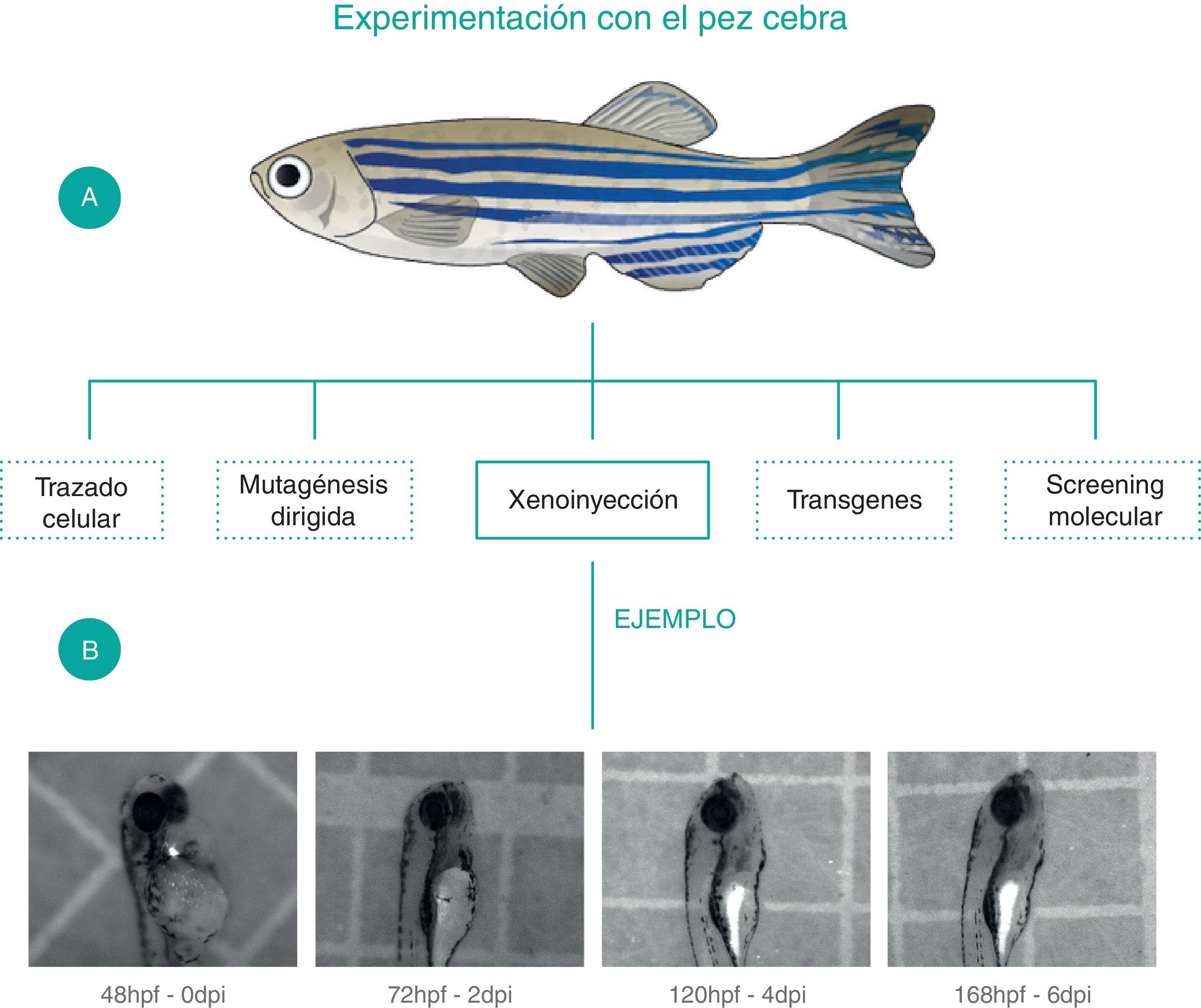 La leucemia linfoblástica aguda y modelos animales alternativos para su  estudio en Colombia | Revista Colombiana de Cancerología