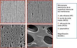 Microfotografía de la cara interna de los 4 tipos de membranas en función del tamaño de los poros: A) alta eficacia (HF); B) punto de corte medio (MCO) (Theranova®); C) alto punto de corte (HCO); D) plasmafiltro. Magnificación 60.000×.