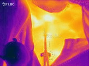 Ejemplo de una fotografía térmica del área de inserción del catéter perteneciente a uno de los pacientes incluidos.