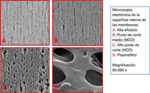 Microscopia electrónica de la superficie interna de distintos tipos de membrana.