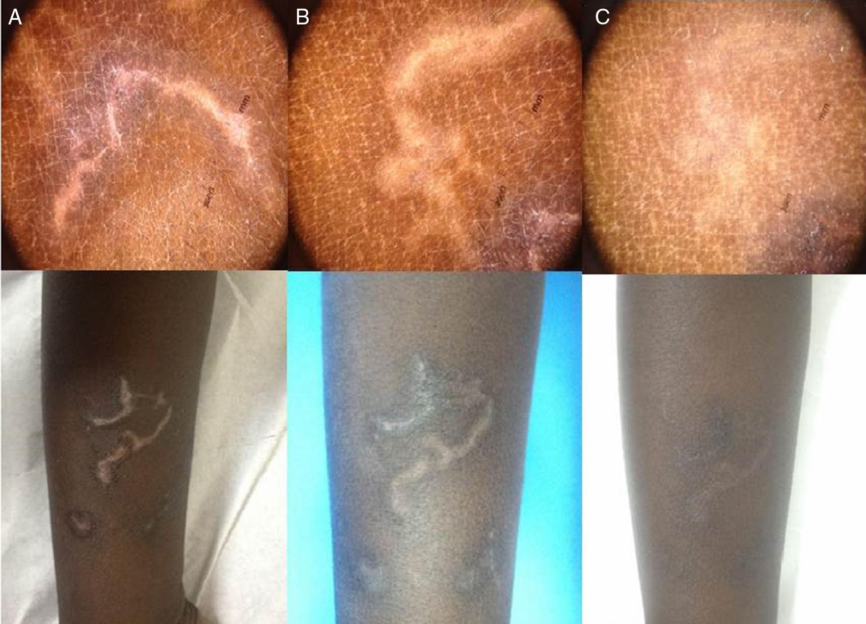 Ivermectin 12 Mg Albendazole 400 Mg