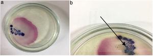 (a) Positive test and (b) confirmation test of E. coli.