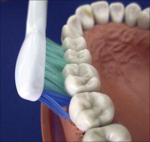 Los cepillos sónicos se co en un ángulo de 45° y se des de diente a diente con una presión leve.