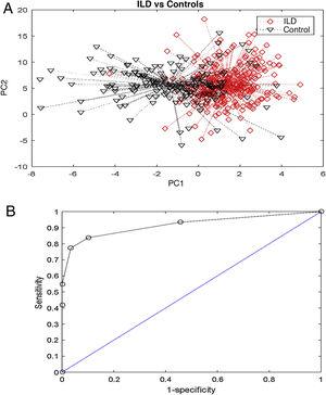 VOC (breathprint) profile in the ILD and control groups. (A) Principal component analysis showing differences in breathprint between patients with ILD and healthy subjects (90% cross-validation accuracy [p < 0.001]). (B) AUROC curve for the discrimination of ILD subjects according to their breathprint.