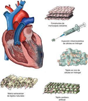 Ingeniería tisular cardiaca. Dibujos esquemáticos de los diferentes abordajes realizados en el campo de la ingeniería tisular cardiaca.