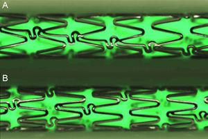 Diseño del stent convencional de cromo-cobalto Architect®, la plataforma metálica del control, stent liberador de fármaco 1 y stent liberador de fármaco 2 (A); la nueva plataforma metálica, estructural del stent liberador de fármaco 3, tiene mayor número de coronas por segmento y conectores no concatenados para permitir una liberación del fármaco más uniforme (B). Imágenes de alta definición obtenidas con el sistema QSix® (Barcelona, España).