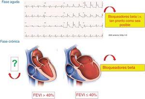 Situación actual de los bloqueadores beta en las distintas fases del síndrome coronario agudo. FEVI: fracción de eyección del ventrículo izquierdo; IAM: infarto agudo de miocardio; i.v.: intravenosos.
