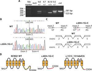 Efecto de las variantes en KCNQ1. A: fragmentos amplificados en las reacciones de RT-PCR de portadores de la variante c.604+1G>C en la familia 1. B: cromatogramas que muestran las secuencias de una persona sana (panel superior) y una portadora de la variante c.604+1G>C. C: efectos de la variante sobre el splicing del ARNm. AG: sitio acepador; GT: sitio donador; GT*: sitio donador críptico; CT: variante. D: efecto de las variantes c.604+1G>C y c.1513_1514delCA en la estructura de la proteína Kv7.1. Las cajas amarillas representan las hélices anfipáticas. La zona en rojo de las proteínas indica la secuencia en que cambia el marco de lectura. Esta figura se muestra a todo color solo en la versión electrónica del artículo.