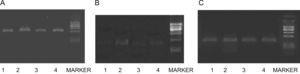Image of gel of RT-PCR for CSE(A),CBS(B) and β-actin(C) mRNA from nasal mucosa of guinea pigs. Sizes of PCR products were 400bp(CSE),155bp(CBS) and 240bp(β-actin).Lanes 1–5 (from left to right) were products of AR, control, PPG, NaHS groups and DNA marker (100∼600bp).There was a decrease in CSE cDNA in AR group compare with control, and it increased after NaSH treated and decreases after PPG treated, whereas there was no change in β-actin mRNA. The expressions of CBS mRNA were so weak that no significant difference between groups was found.