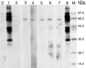 SDS–PAGE immunoblotting-inhibition. Curry extract in solid phase. Control serum (C), patient serum (1). Patient serum preincubated with extracts from: curry (2), cumin (3), coriander (4), Artemisia vulgaris pollen (5), Chenopodium album pollen (6), Platanus acerifolia pollen (7), lamb (8). M: molecular weight standards.
