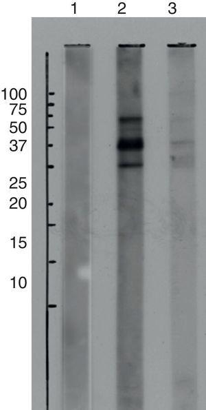 Immunoblotting performed after transfer from SDS-PAGE with red and green peppers extracts. Lane 1: red and green pepper extracts without patient's serum. Lane 2: red pepper extract with patient's serum. Lane 3: green pepper extract with patient's serum.
