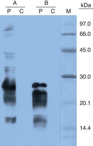 SDS-PAGE IgE immunoblotting result. (A) Fresh coconut extract. (B) Coconut milk extract. Lane P: patient serum. Lane C: control serum (pool of sera from non-atomic subject). Lane M: molecular mass marker.