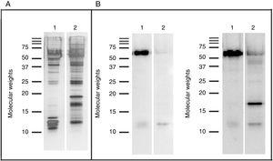 Western blot results: SDS PAGE (A) and IgE-Western blot (B) with serum from patients sensitized to garlic (left) and serum from patients sensitized to onion (right). Lane 1: Garlic, Lane 2: Onion.