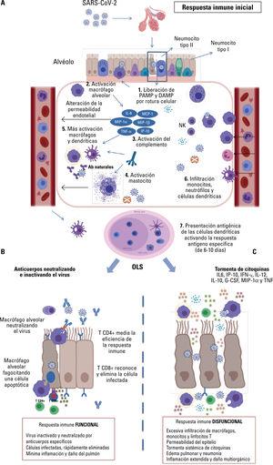 A. Fase inicial aguda en la infección por SARs-CoV-2. 1. El epitelio alveolar libera PAMP (patrones asociados a los patógenos) y DAMP (patrones asociados al daño). 2. Los macrófagos alveolares reconocen los PAMP y DAMP e inician el proceso de inflamación liberando citocinas proinflamatorias. 3 y 4. Activación del sistema del complemento y desgranulación de mastocitos. 5. Activación de macrófagos derivados de monocitos y células dendríticas productoras de citocinas inmigrantes. 6. Amplificación de la respuesta, alteración de la permeabilidad endotelial aumentando la infiltración de monocitos, células dendríticas y neutrófilos. 7. Presentación antigénica de células dendríticas a linfocitos T en los OLS (órganos linfoides secundarios) y activación de linfocitos B para la producción de anticuerpos específicos. B. Respuesta eficiente del sistema inmune. Neutralización del virus por anticuerpos específicos y apoptosis de las células alveolares infectadas mediante señalización de linfocitos Th y eliminación de estas los Tc. Las células apoptóticas son fagocitadas por macrófagos alveolares. C. Respuesta disfuncional del sistema inmune. Masiva infiltración de células del sistema inmune innato, tormenta de citocinas, profundo daño endotelial y alteración de la permeabilidad del epitelio alveolar (figura realizada con BioRender).