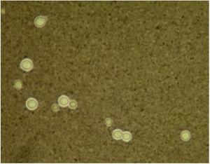 The special microorganism stain. The India ink stain showed characteristic capsulated budding yeast cells with distinct halos (x40).