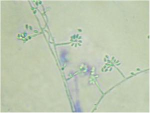 Colony micromorphology at 25°C, showing septate hyaline hyphae, conidiophores that originate primary hyaline conidia in a “daisy” arrangement (cotton blue, ×400).