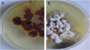 Second patient Sabouraud’s Dextrose Agar culture. (A), Reverse of colony with a yellow-brown color. (B), Front view with white powdery colonies. These findings are compatible with T. rubrum.