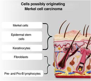 Main cells postulated as responsible for the genesis of MCC