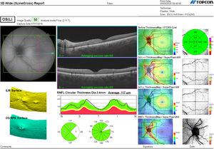 Tomografía de coherencia óptica (OCT) utilizando el protocolo 3D-Wide del dispositivo OCT Triton.