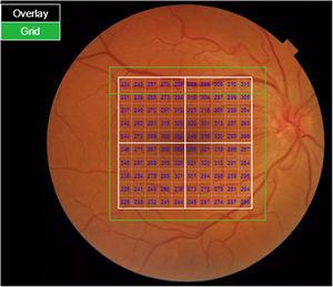 Aplicación Super Pixel Grid-600 para análisis del área macular del dispositivo de tomografía de coherencia óptica (OCT) Triton.