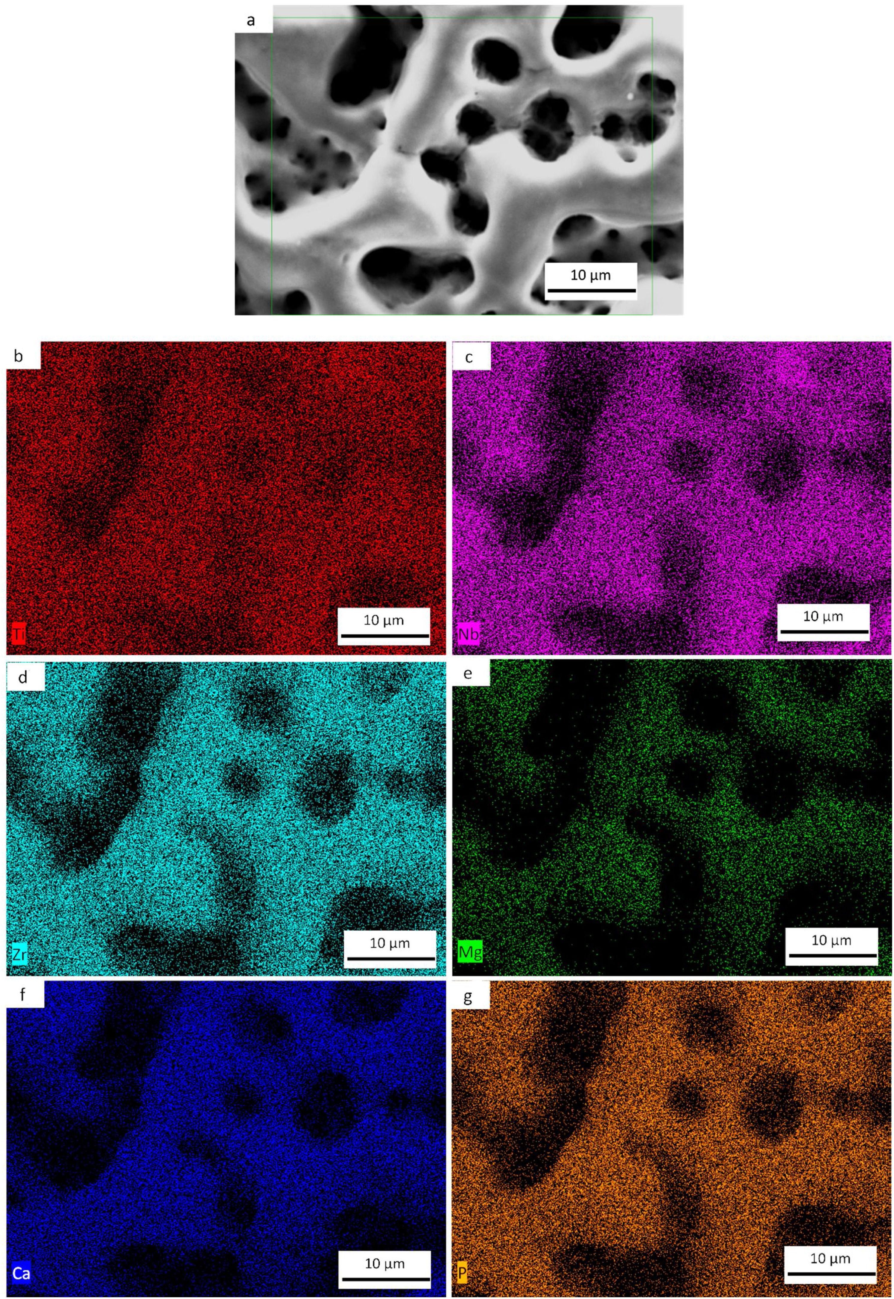 Progress in Niobium Oxide-Containing Coatings for Biomedical