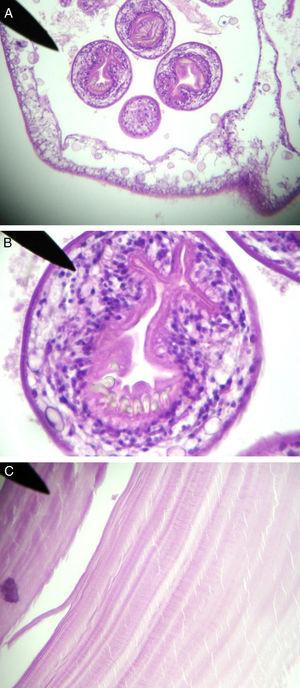 A) Protoescólices y gemación de la capa granulosa. B) Escólex de Equinococcus granulosus con ventosa y ganchos. C) Capa anhista del quiste.