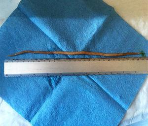 Ascaris lumbricoides de 27cm de longitud.