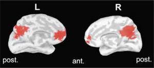 Esta figura muestra la red por defecto en una vista medial del cerebro humano, usando la metodología de la solución inversa en EEG. En rojo, el patrón de activación observado durante el reposo, donde se involucra el precúneo o cín-gulo posterior (región posterior) y la región frontal medial (anterior). Estas regiones tienden a desactivarse cuando el sujeto se involucra en una tarea cognitiva, al contrario de lo que sucede en regiones de la red de enganche (no mostradas). L, izquierda (Left); R, derecha (Right).