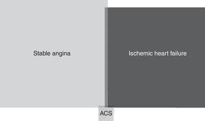 Proportional contribution of acute coronary syndrome, stable angina and ischemic heart failure to years lived with disability due to due to ischemic heart disease in mainland Portugal, 2013. ACS: acute coronary syndrome.