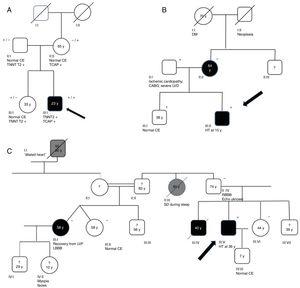 Genograms in three families of dilated cardiomyopathy patients. (A) Family with multiple variants in TNNT2 (c.325C>T, p.His109Tyr) and TCAP (c.313G>C, p.Glu105Gln), in which the phenotype is only expressed in cases of double heterozygosity, and the presence of just one variant is not associated with the expression of DCM; (B and C) families with non-segregating TNNT2 variant (c.325C>T, p.His109Tyr) and LMNA variant (c.460G>A, p.Glu154Lys), respectively. Square: male; circle: female; black symbol: dilated cardiomyopathy; gray symbol: probable cardiac pathology; crossed symbol: deceased family member; arrow: proband; +/− symbols: presence/absence of the variant; numbers inside the symbols: age (years); ?: unavailability for clinical/genetic assessment; CABG: coronary artery bypass grafting; CE: cardiac evaluation; HT: heart transplantation; LBBB: left bundle branch block; LVD: left ventricular dysfunction; LVF: left ventricular function; RBBB: right bundle branch block; SD: sudden death; y: years.