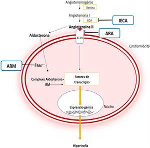 Importância do SRAA na fisiopatologia da MCH e mecanismo de ação dos diferentes fármacos inibidores deste sistema44,45 Legenda: ARA‐ antagonista do recetor da angiotensina; ARM‐ antagonista do recetor dos mineralocorticóides; AT1R‐ recetor tipo 1da angiotensina II; CaMKII‐ proteína cinase II Ca2+/calmodulina dependente; ECA‐ enzima conversora da angiotensina; IECA‐ inibidor da enzima conversora da angiotensina; JAK‐ Cinase Janus; MEF2‐ fator 2 ativador do miócito; NF‐κB‐ fator de transcrição nuclear kappa B; RM‐ recetor de mineralocorticóides; STAT‐ transdutor de sinal e ativador da transcrição.