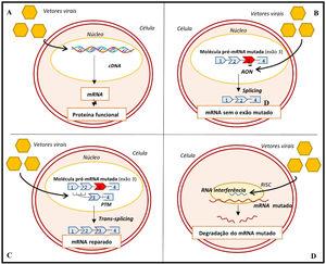 Abordagens genéticas para o tratamento da MCH. A‐ gene transfer; B‐ skipping de exões; C‐ técnica SMaRT; D‐ silenciamento alélico com RNAi57,63,64 Legenda: AON‐ oligonucleotidos antissense; cDNA‐ ácido desoxirribonucleico complementar; mRNA‐ ácido ribonucleico messangeiro; PTM‐ molécula pré‐trans‐splicing; RISC‐ complexo silenciador induzido por ácido ribonucleico.