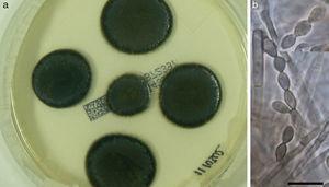 Cladophialophora bantiana, FMR 12155. (a) Colonies on Sabouraud agar at 30°C after seven days. (b) Chains of conidia. Bar=10μm.