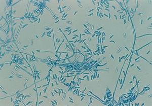 Fusarium solani conidia stained with lactophenol cotton blue (40×).