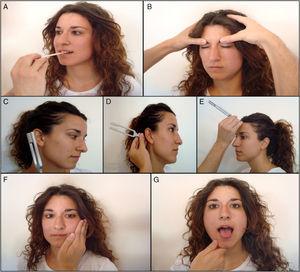 Exploración de pares craneales: A) Trigémino (V): nervio mandibular. B) Facial (VII): prueba del orbicular de los párpados. C y D) Vestibulococlear (VIII): prueba de Rinne. E) Vestibulococlear (VIII): prueba de Weber. F) Espinal (XI). G) Hipogloso (XII).
