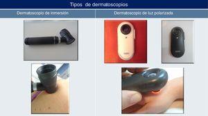 Ejemplos de dermatoscopios portátiles.