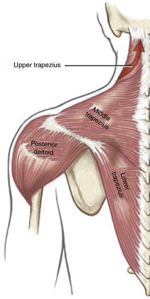 The 3 parts of the trapezius muscle. The posterior deltoid is also illustrated. Note that the red arrow shows the line of action of the upper trapezius muscle.