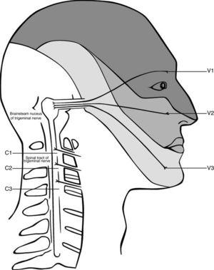 Convergence of the cervical and trigeminal nerves in the brainstem. Adapted from Haldeman and Dagenais, 2001.79
