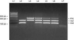 Multiplex PCR for detection of nuc, mecA, and PVL genes. Multiplex PCR was performed to detect the presence of nuc, mecA and PVL genes in isolates from medical students to confirm Staphylococcus aureus species (nuc gene), methicillin resistance (mecA gene) and presence of PVL genes. Lane 1: MW (DNA molecular weight markers). Lane 2: ATCC 33591 reference strain (nuc+, mecA+, PVL-). Lane 3: ATCC 25923 reference strain (nuc+, mecA-, PVL+). Lanes 4 to 6: MRSA isolates from the study. Lane 7: negative control for the PCR reactions.