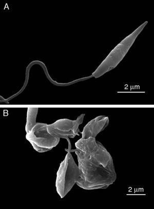 Scanning electron microscopy was performed to determine severe alterations in the morphology of zerumbone treated L. donovani-promastigotes in comparison to control culture. Images are representative profile of at least three independent experiments.