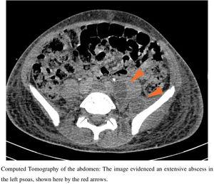 Computed tomography (CT) of the abdomen.