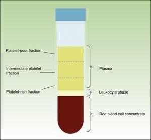 Different fractions obtained after centrifugation of anticoagulated blood.