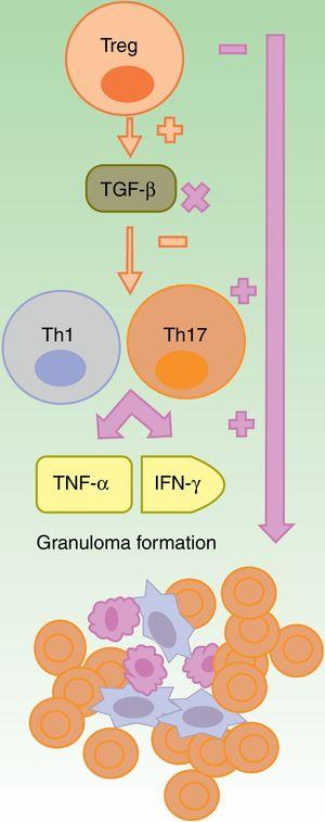 Formation of sterile granulomas during therapy with anti-TNF-α agents. The anti-TNF-α agents are partially effective, in general, in granulomatous diseases such as Crohn disease or sarcoidosis. It is suggested that this is due to an imbalance caused by their use, with an increase in Th17 cell function. Among this class, etanercept causes granulomatous reactions most often because, on the one hand only partial blockade of TNF-α occurs and, on the other, TGF-β is not produced thus allowing overproduction of IFN-γ and TNF-α, which are essential for aseptic granuloma development IFN: interferon; TGF: transforming growth factor; Th: T helper cell; TNF tumor necrosis factor; Treg: T regulatory cell;.